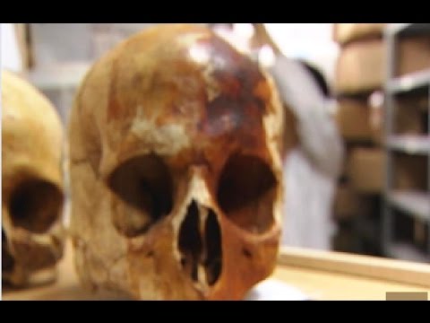 La antropología forense es una de las subdisciplinas de la antropología física y se…