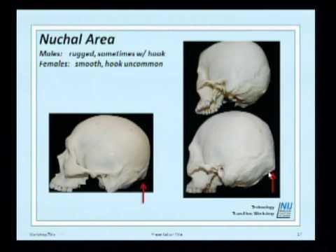 Forensic Anthropology 2011. Part of the free online training on «Advances in Forensic…