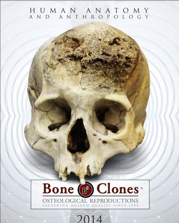 Bone Clones.