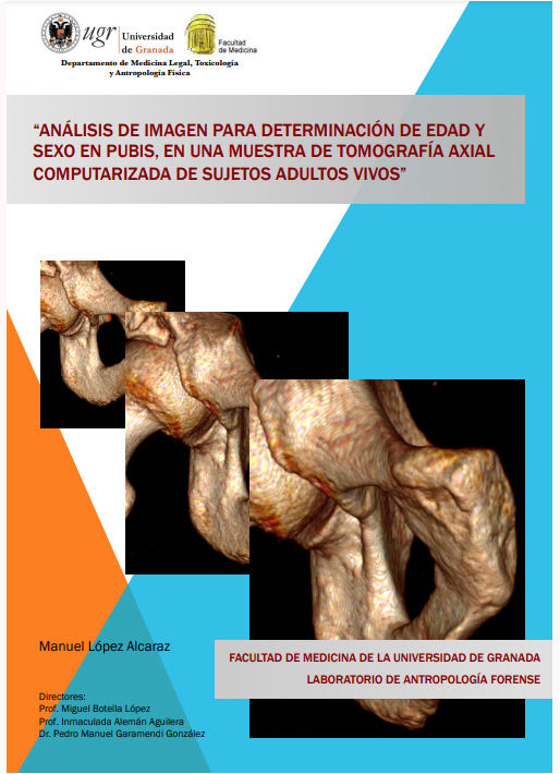 TESIS DOCTORAL DE D. MANUEL LÓPEZ ALCARAZ. «Análisis de imagen para determinación de edad y sexo en pubis, en una muestra de TAC de sujetos adultos vivos».